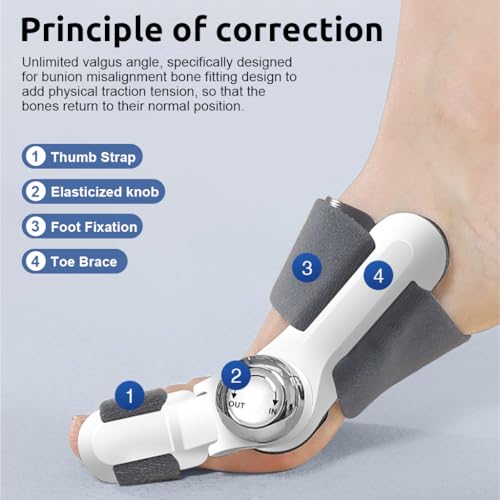 HANNEA® Bunion Corrector Orthopedic Toe Straightener 4 Angle Adjustable Splint Direction for Right Left Foot 2 PCS