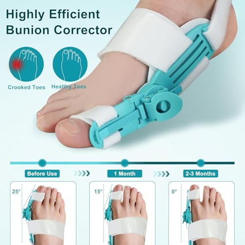 HANNEA® Bunion Thumb Corrector Adjustable Toe Separators for Women Men with Rotating Knob Orthopedic Fit Left Right Foot 3PCS