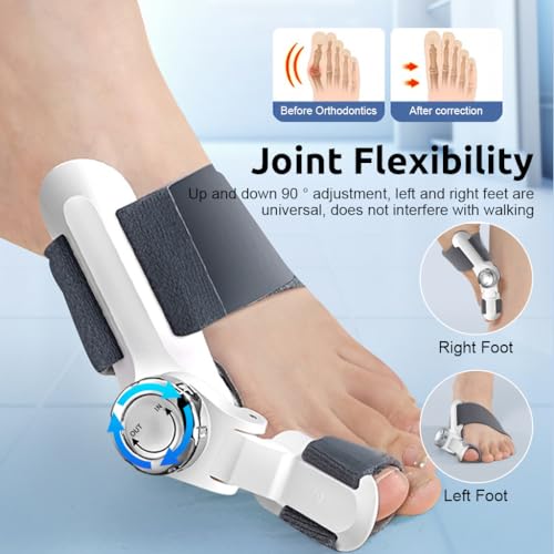 HANNEA® Bunion Corrector Orthopedic Toe Straightener 4 Angle Adjustable Splint Direction for Right Left Foot 2 PCS