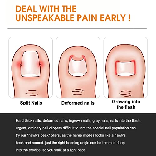 MAYCREATE® Ingrown Toenail Clippers for Thick Toenails Wide Jaw Opening Nail Curved and Slant Straight Blade Edge 12PCS Stainless Steel Toe Clipper Men