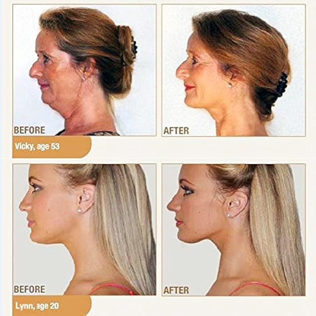Proberos Men's and Women's Neck Slimmer
