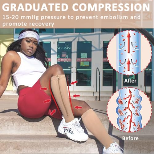 HANNEA 1 Pair Zipper Compression Socks, 15-20 mmHg Closed Toe Compression Stocking with Zipper, Calf Knee High Open Toe Compression Stocking for Women and Men, S/M