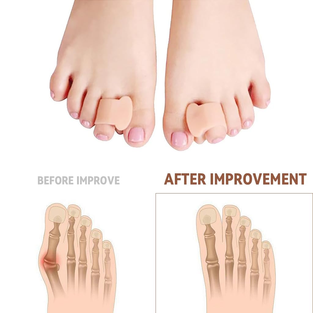 HANNEA 4Pcs Gel Toe Separators 2 Sizes Toe Spacers Reuseable Toe Spacers Toe Separators for Pedicures, Bunions, Hammer toes