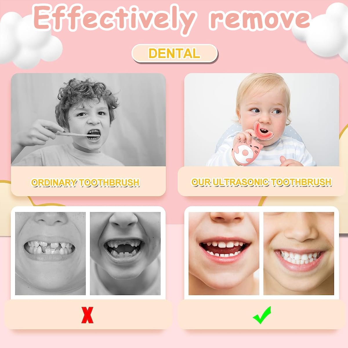 HANNEA Toothbrush For Kids, Electric U Shaped Ultrasonic Brush Tooth, Chargeable automatic Tooth Brush With 3 Cleaning Modes IPX7 Waterproof USB Rechargeable Toothbrush (Ages 3-7)
