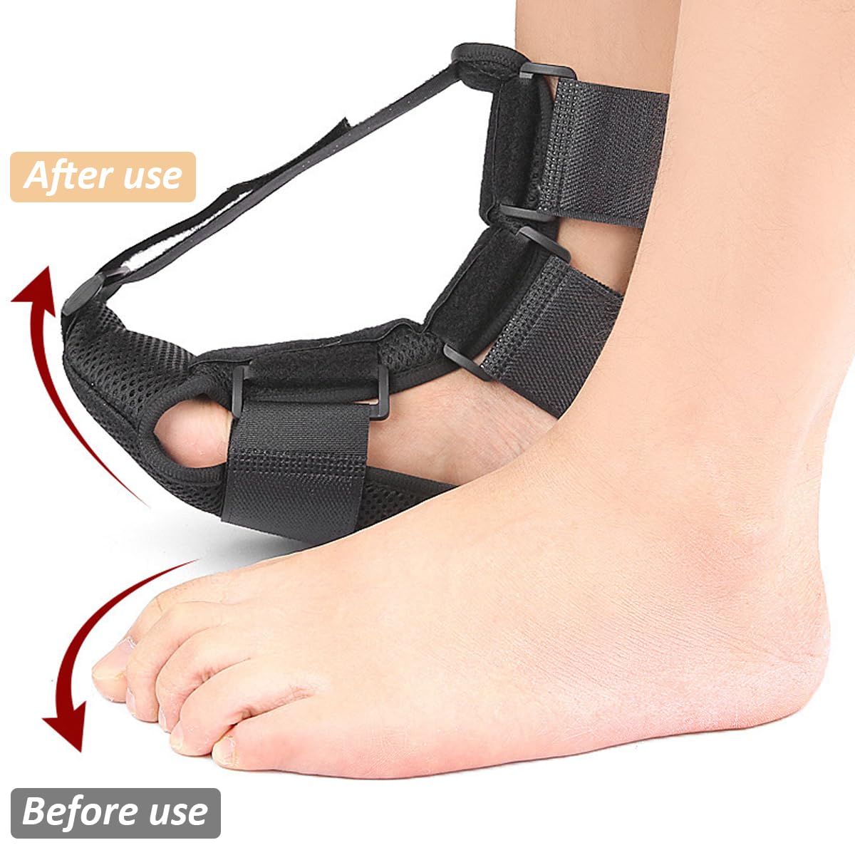 HANNEA Ankle-foot Orthosis, Foot Drop Splint Adjustable Ankle-foot Orthosis Wearable Night Splint for Improve Foot Drop Gentle Foot Support for Pain Relief and Healing