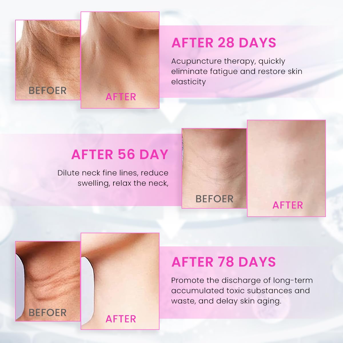 HANNEA EMS Beauty Machine Anti-aging Neck Massager 3 in 1 Anti Wrinkles Face Massager EMS Micro-current Neck Massager Remove Double Chin Tighten Facial Contour Prevent Wrinkles, White