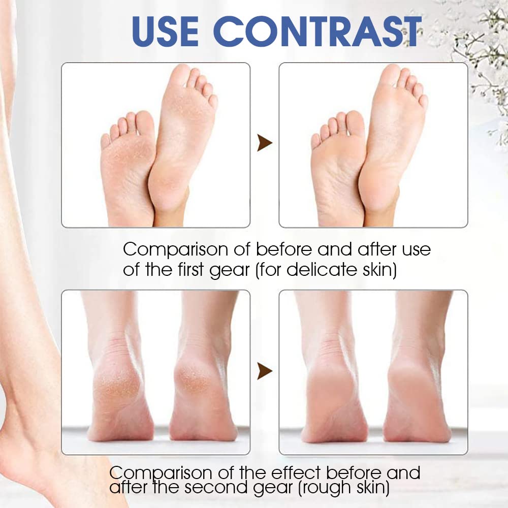 HANNEA Electric Callus Removers, Pedicure Scrubber For Women Pedicure Machine Rechargeable Electronic Pedicure Tools, Portable Pedicure Device for Callus, Professional Feet Care Kit at Home