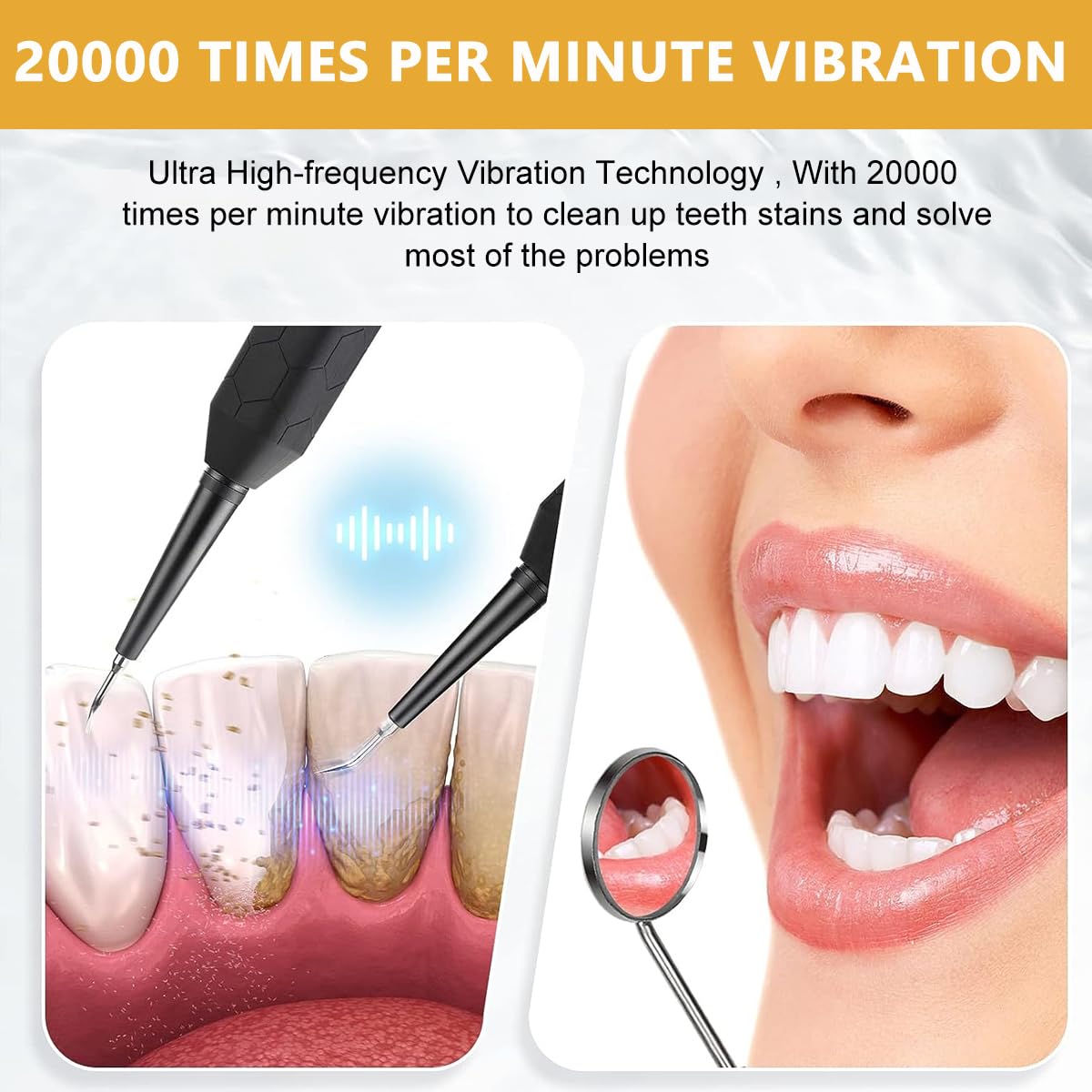 HANNEA Plaque Remover for Teeth, Teeth Cleaning Kit with LED Light, 2 Replaceable Heads and Oral Mirror, 3 Modes Teeth Cleaner for Travel & Home Use