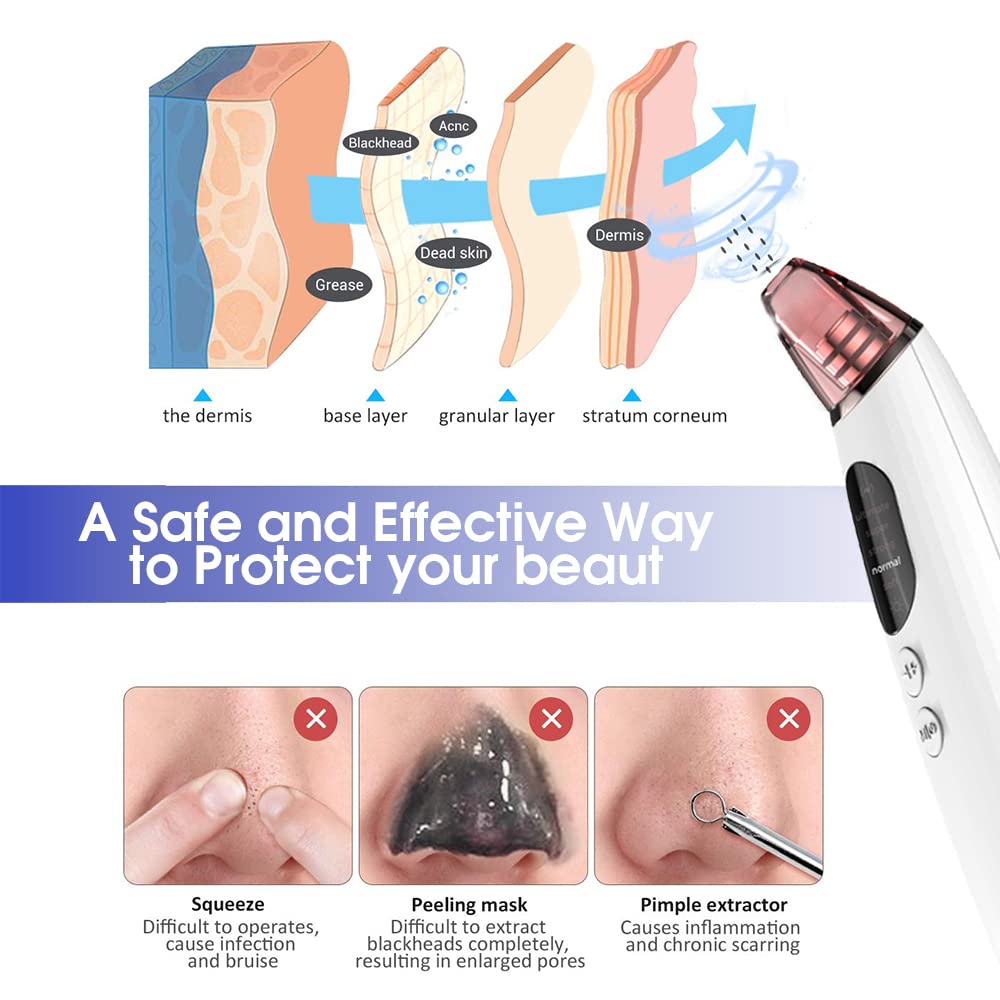 MAYCREATE Blackhead Remover Pore Vacuum Cleaner with Heat Compress, Facial Pore Cleaner Suction, Electric Acne Comedone Whitehead Vacuum Cleaner with Accessories For Women
