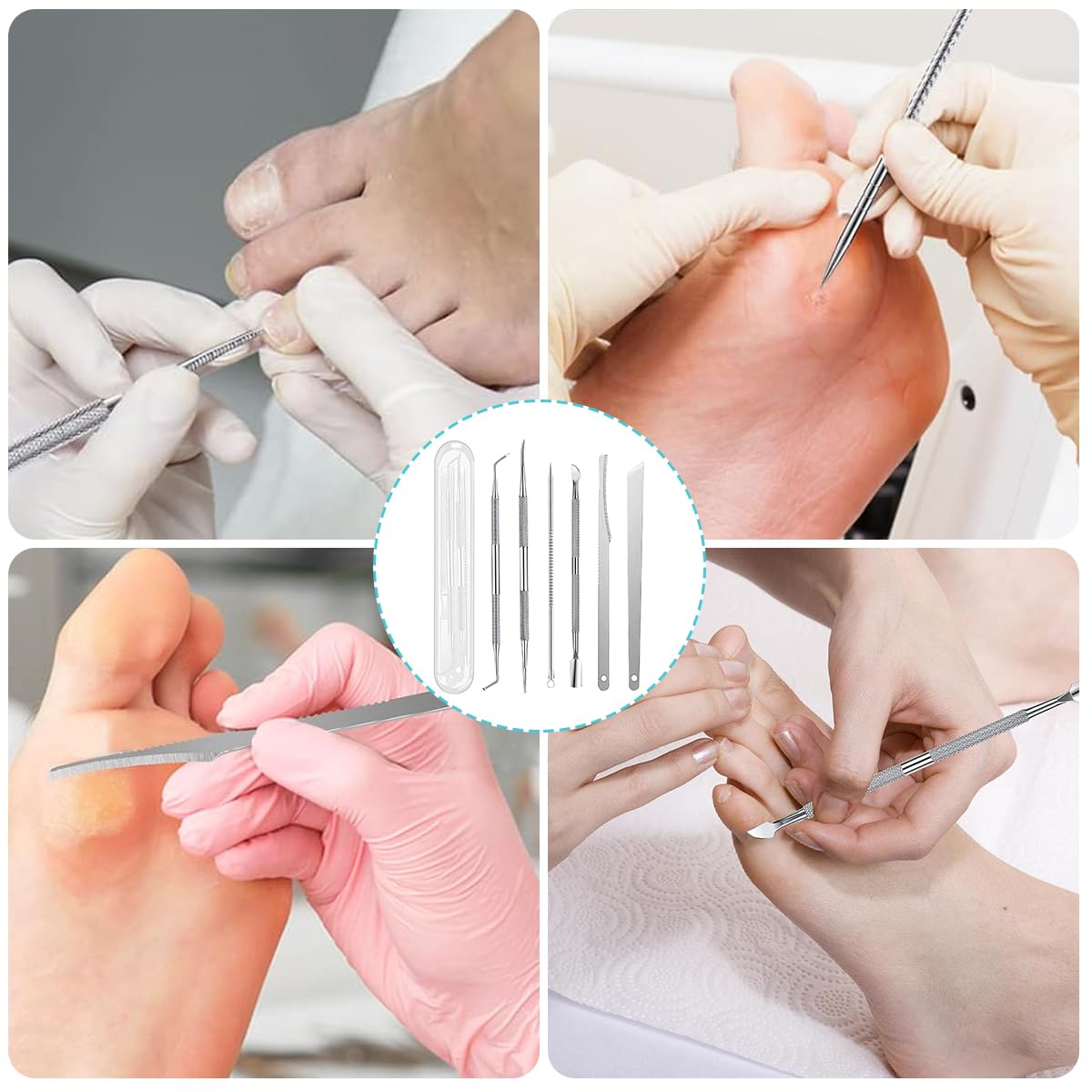 MAYCREATE 6pcs Ingrown Toenail Tool, Toenail File and Lifters, Foot Skin Scraper Surgical Stainless Steel Ingrown Toenail Removal Tool Kit, Nail Cleaner Tools with Box
