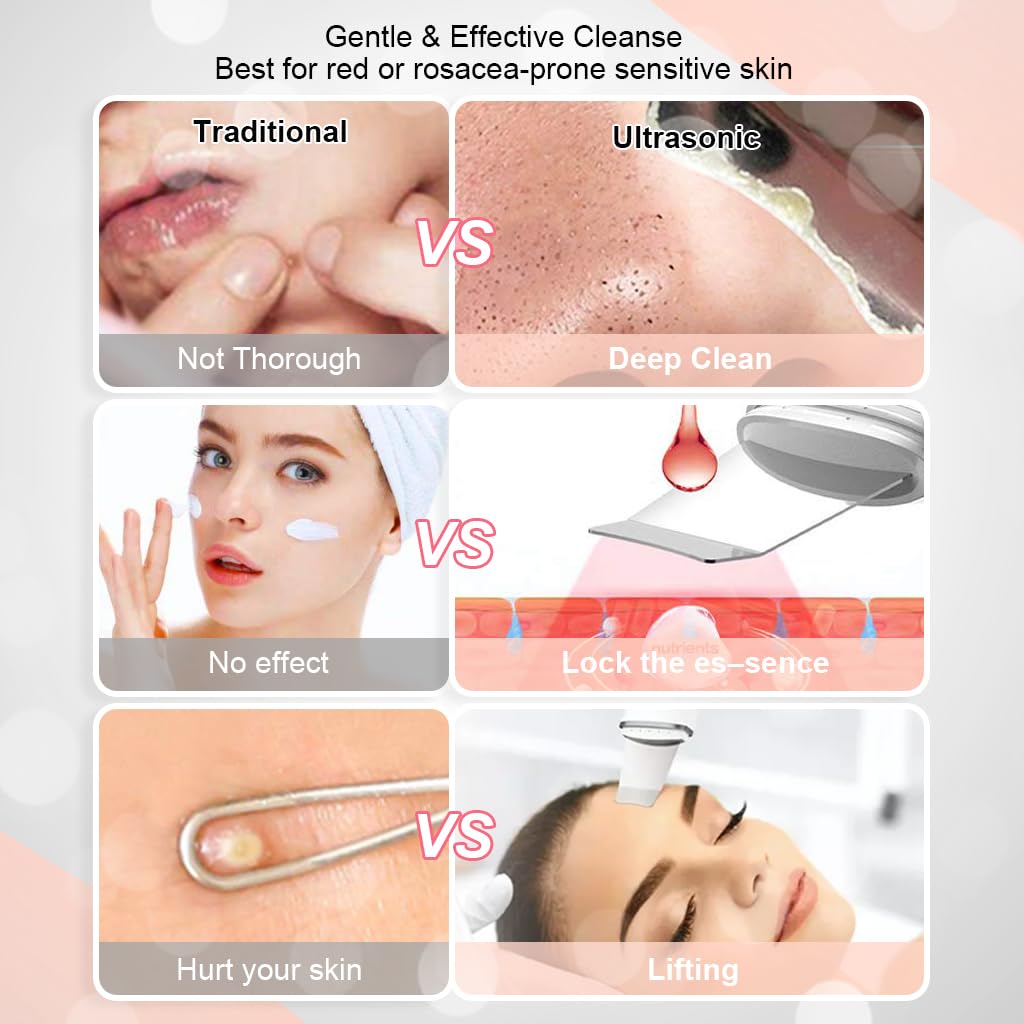 HANNEA Skin Scrubber Blackhead Remover Tool Ultrasonic Facial Cleaner Massager Machine Skin Scraper USB Rechargable 4 Modes Skin Spatul with LCD