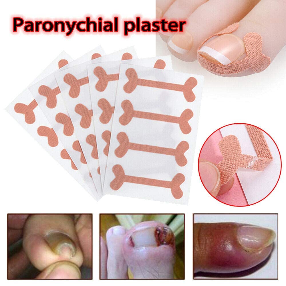MAYCREATE Ingrown Toenail Treatment Tool Kit 8 Pieces Ingrown Toenail Corrector Kit Includes Ingrown Toenail Lifter, Ingrown Toenail Cuticle Tool, 16 Toenails Brace Stickers, Toenail File