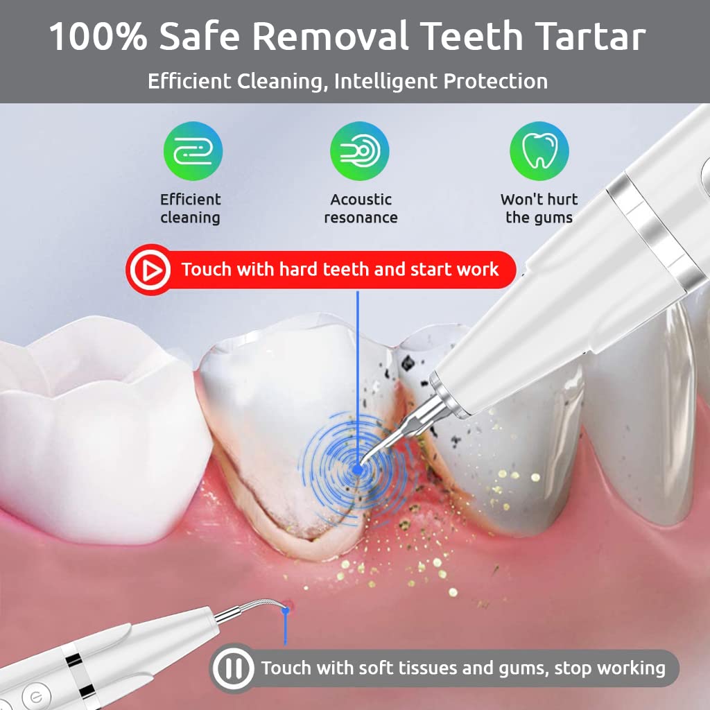 HANNEA Plaque Remover for Teeth, Teeth Cleaner Dental Calculus Remover Teeth Cleaning Kit with Led, Adjustable 5 Modes, Replaceable Clean Heads Safe for Adult Kids