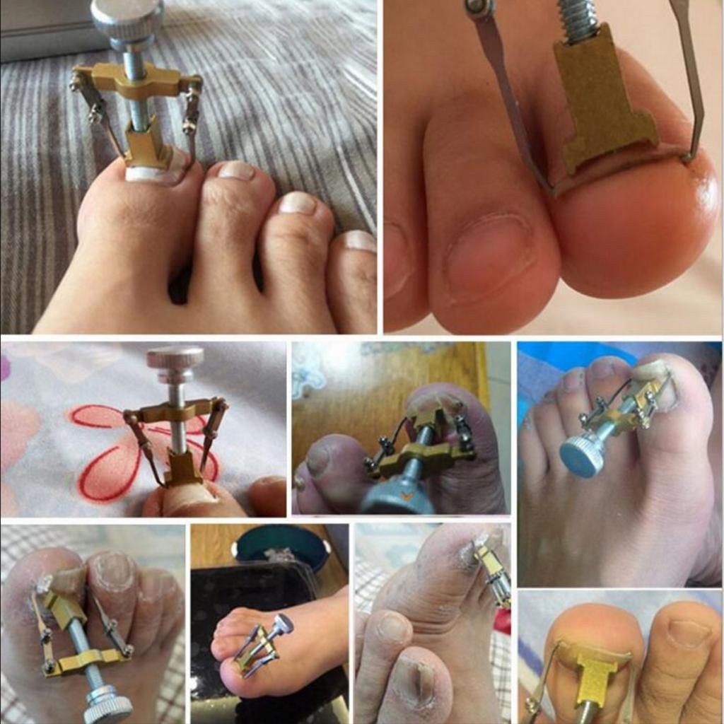 HASTHIP® 9PCS Toe Nail Correction Tool Pedicure Ingrown Lifter Stainless Steel Clipper Nipper
