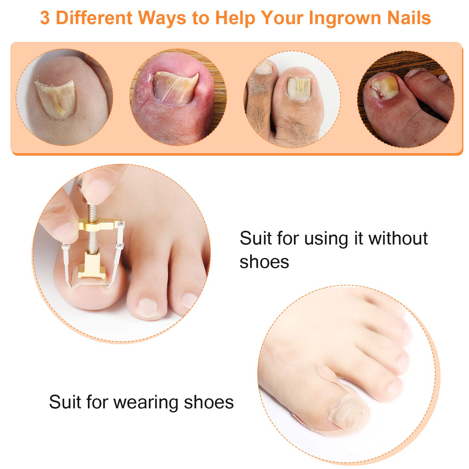 MAYCREATE Ingrown Toenail Treatment Tool Kit 8 Pieces Ingrown Toenail Corrector Kit Includes Ingrown Toenail Lifter, Ingrown Toenail Cuticle Tool, 16 Toenails Brace Stickers, Toenail File