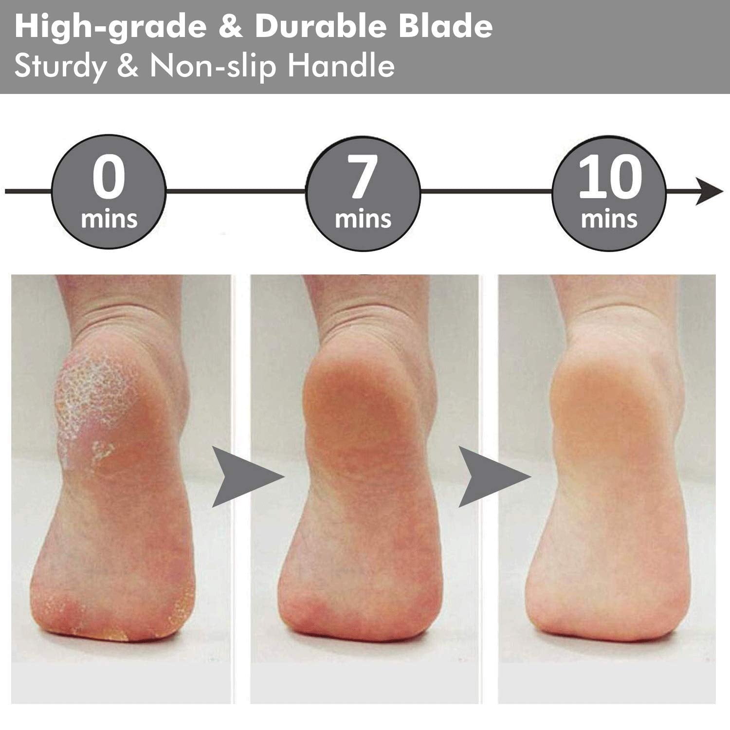 ZORBES Segolike Stainless Steel Rasp Callus File Blade Foot Care, (Grey)