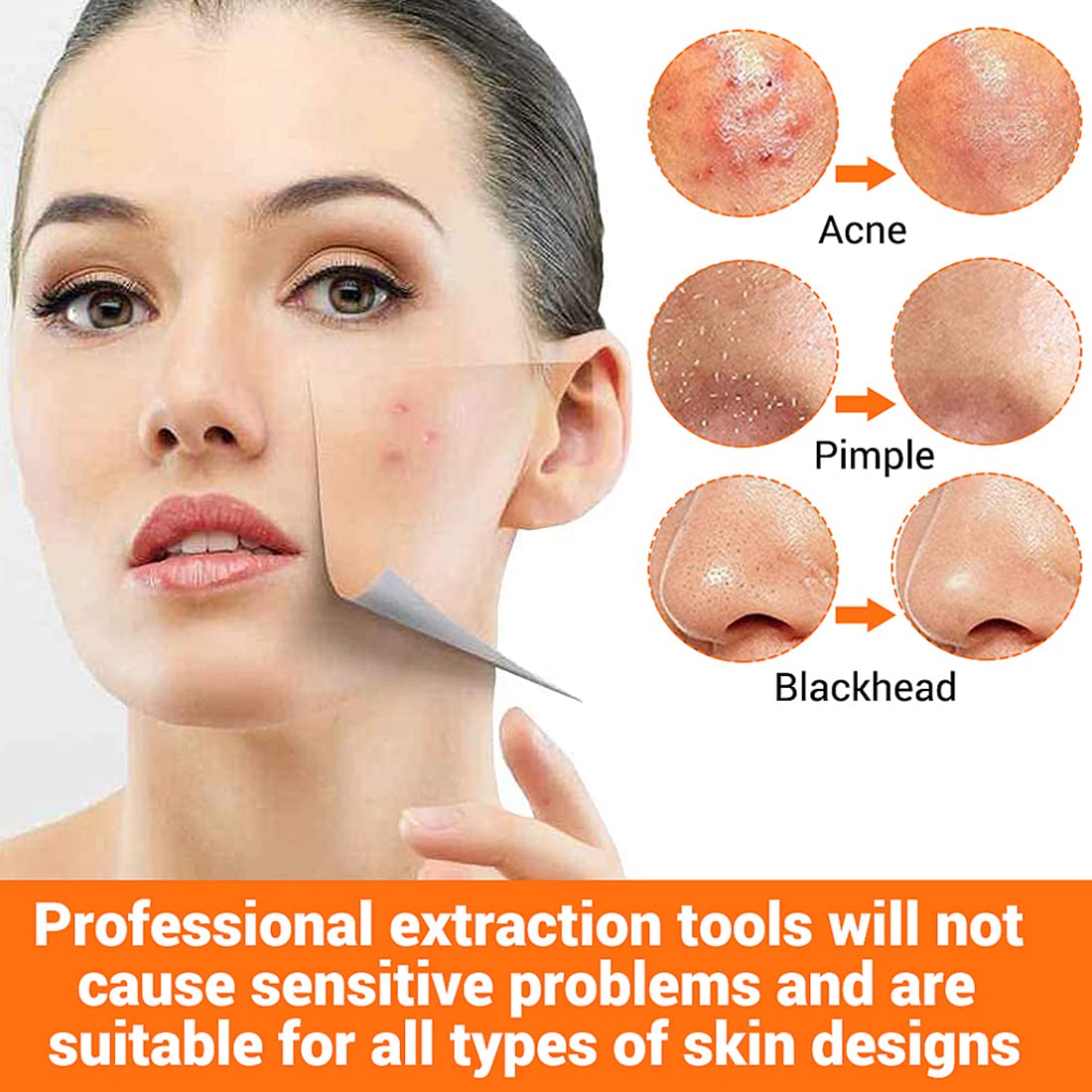 MAYCREATE 9PCS Blackhead Remover Tools Stainless Steel Blackhead Pimple Blemish Extractor/Remover Tool with Tweezers, Professional Acne Remove Tools