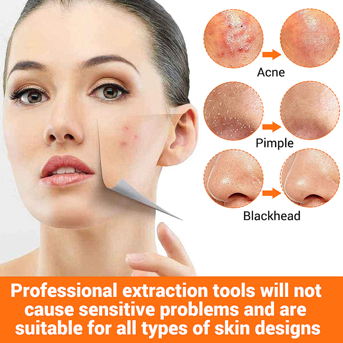 MAYCREATE 9PCS Blackhead Remover Tools Stainless Steel Blackhead Pimple Blemish Extractor/Remover Tool with Tweezers, Professional Acne Remove Tools