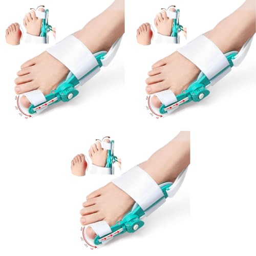HANNEA® Bunion Thumb Corrector Adjustable Toe Separators for Women Men with Rotating Knob Orthopedic Fit Left Right Foot 3PCS