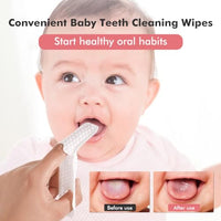 SNOWIE SOFT® 30Pcs Baby Teeth Cleaning Wipes Gum Friendly Soft Baby Use Dental Wipes Finger Cot Tooth Tissues Dry & Wet Use Baby Oral Cleaning Tissues for 0-24 Months