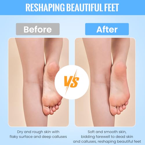 ZIBUYU® Foot Scrubber for Dead Skin Callus Remover with 3 Rollers Pedicure Machine Spa Electric Improve Rough Heel Rechargeable Electronic Tool 3PCS