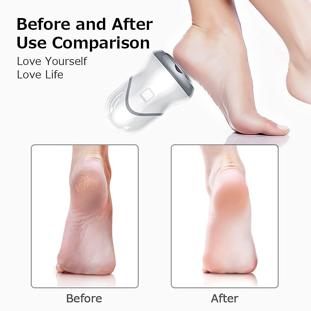 MAYCREATE® Callous Remover Electric USB Rechargeable Foot Callus Remover Pedicure Dead Skin Remover Foot Scrubber for Women Dead Skin Foot Care Tool Cracked Heels Remover Tools