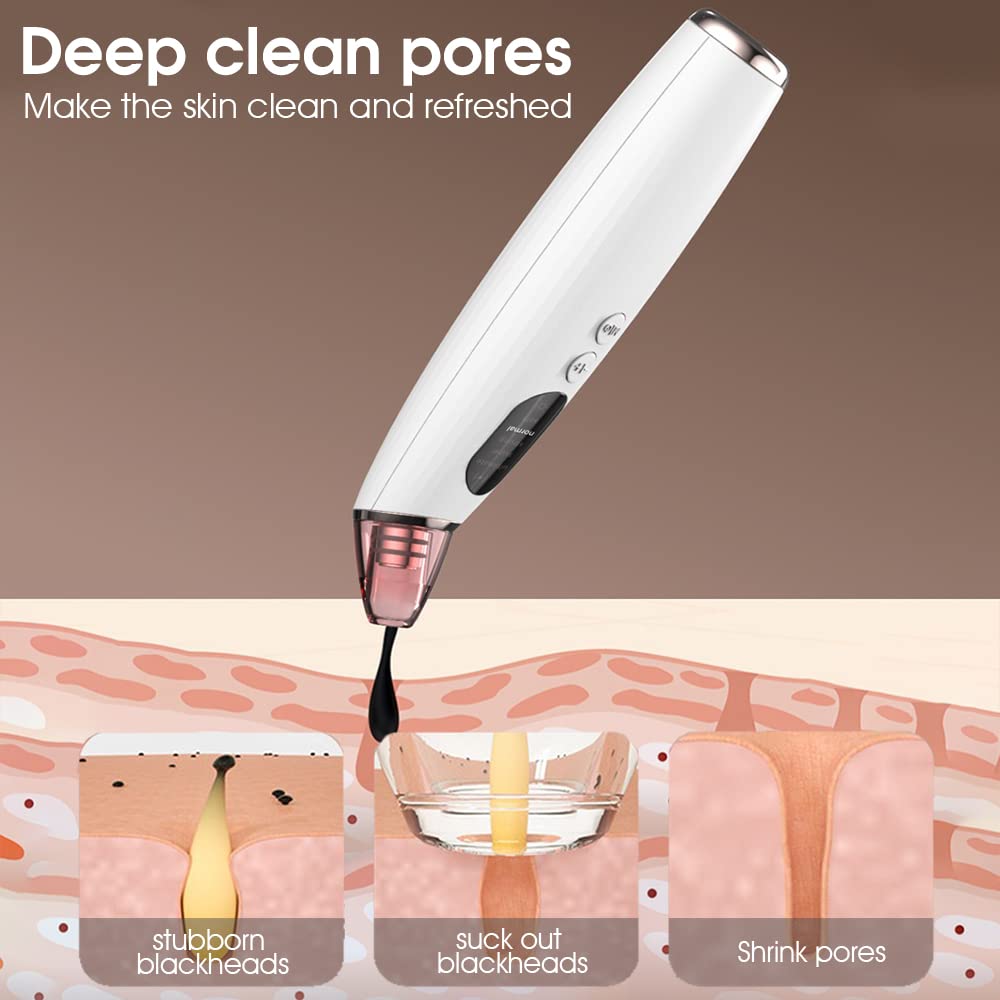 MAYCREATE Blackhead Remover Pore Vacuum for Facial Cleansing with 60Kpa Suction and Heat Compress | USB Rechargeable Tool for Women