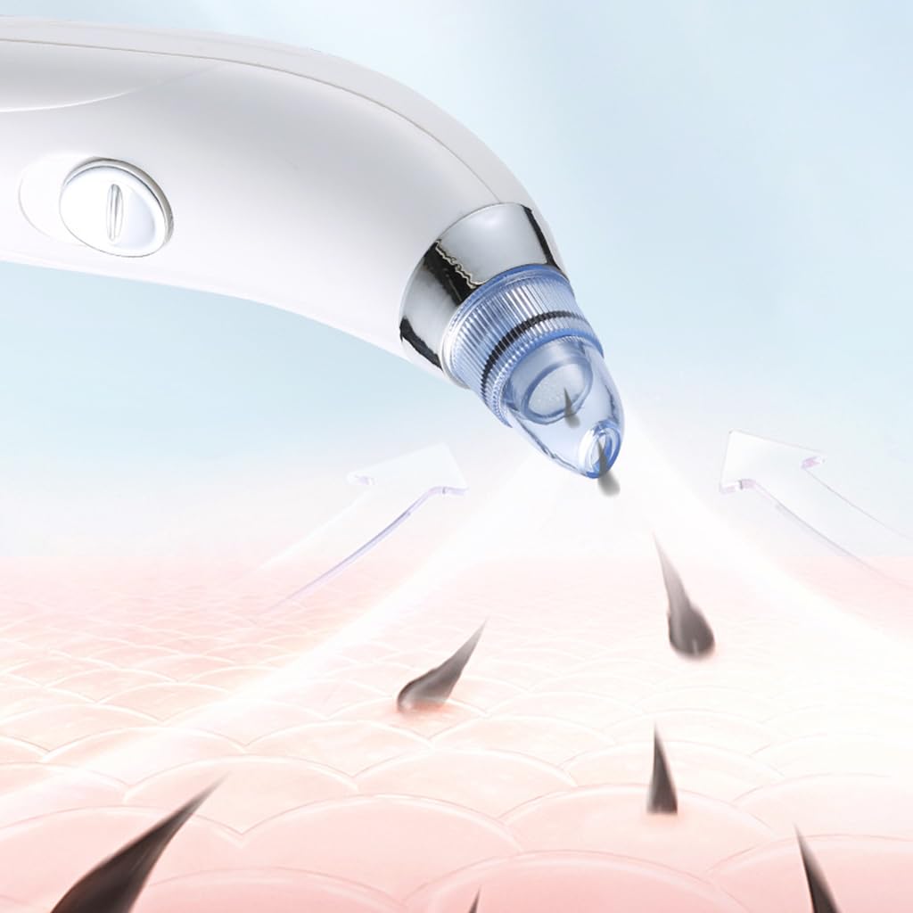 ZIBUYU Blackhead Remover Vacuum for Face with 2 Suction Levels and 4 Nozzles | Battery Powered