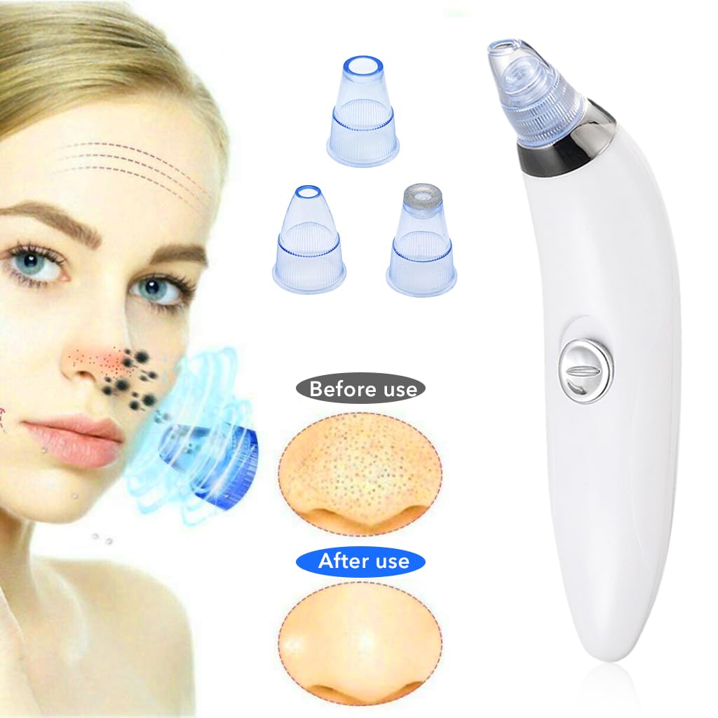 ZIBUYU Blackhead Remover Vacuum for Face with 2 Suction Levels and 4 Nozzles | Battery Powered