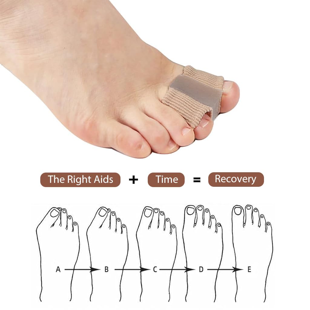 ZIBUYU Toe Separator for Bunion Relief featuring Stretchy Fabric Design | Pack of 2