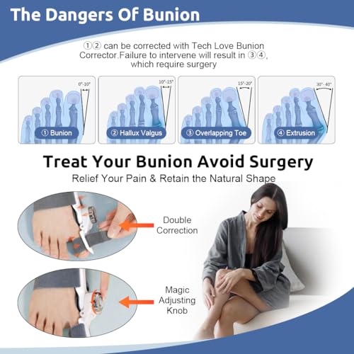 HANNEA® Bunion Corrector Orthopedic Toe Straightener 4 Angle Adjustable Splint Direction for Right Left Foot 2 PCS