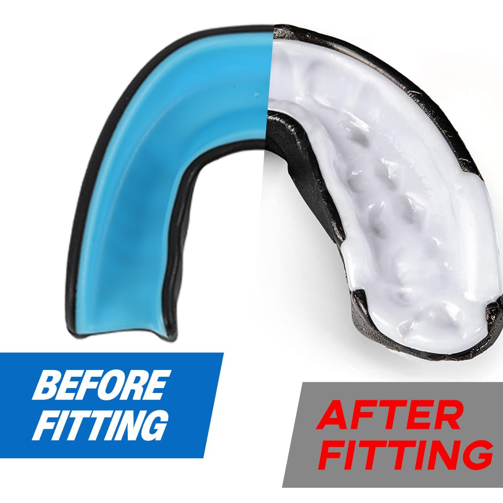 Proberos Mouth Guard for Braces with Customizable Fit for Football and Boxing | Clear Single Pack
