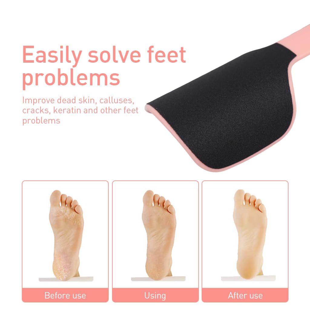 MAYCREATE® Foot Scrubber Heel Callus Remover Dry & Wet Use Shower Food Scrubber Double Side U-Shape Foot File Pedicure Exfoliation Foot Scrubber Heel Foot Scrubber for Dry Feet