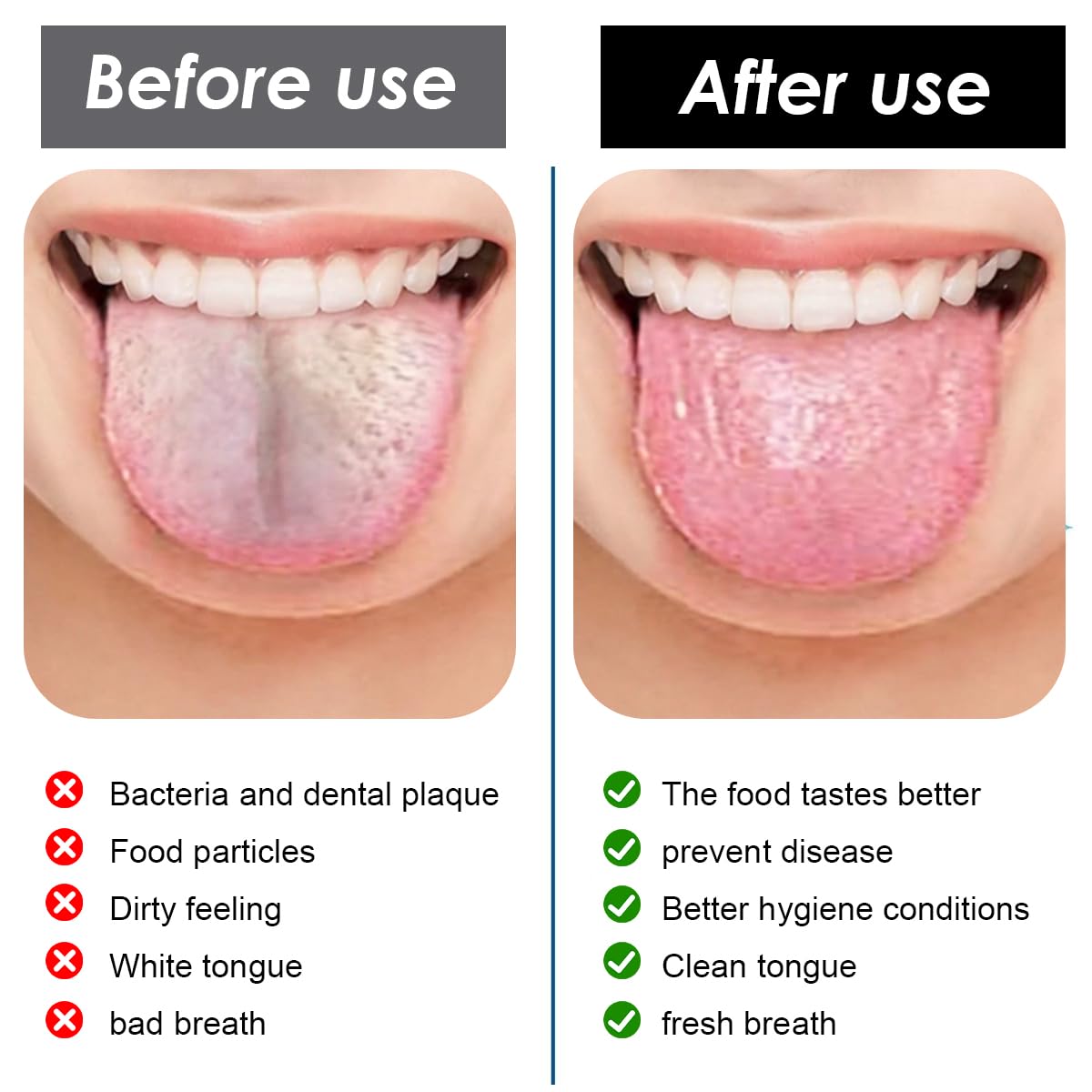 HANNEA Tongue Scraper Cleaner for Fresh Breath with 3 in 1 Double Head Design | Soft Bristles and Nubs