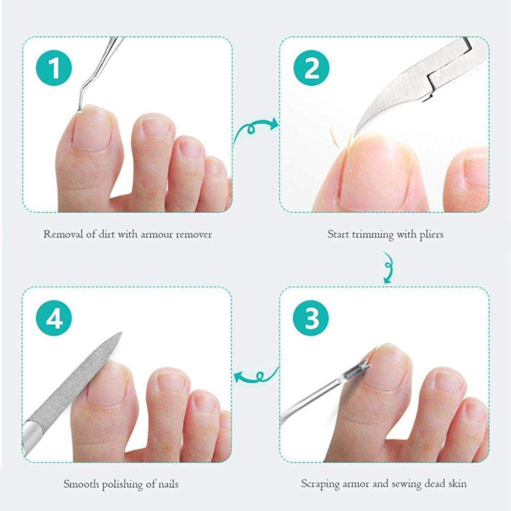 MAYCREATE Toe Nail Clipper for Ingrown or Thick Toenails with Double Spring and ABS Handle | 5PCS Stainless Steel Pedicure Kit