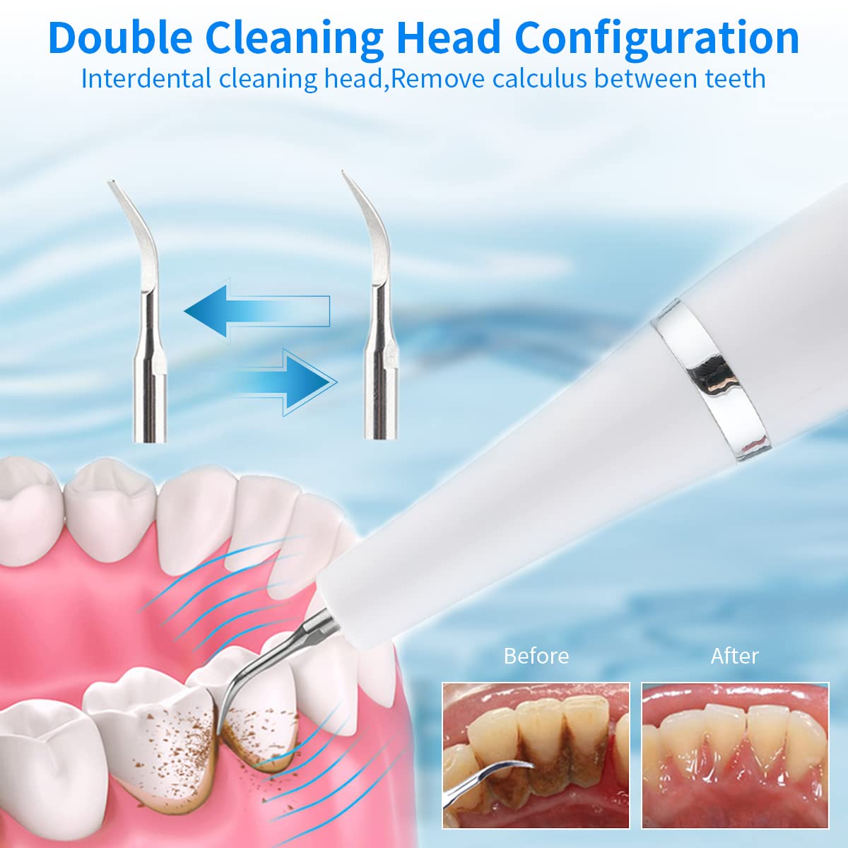 HANNEA Dental Floss Electric Teeth Cleaning Kit with 3 Tips and 4 Modes | USB Rechargeable