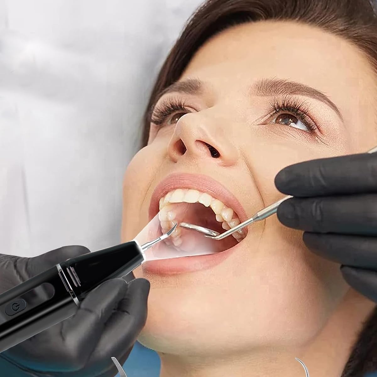 HANNEA Teeth Whitening Kit with LED and 4 Stainless Steel Bits for Deep Cleaning | USB Rechargeable