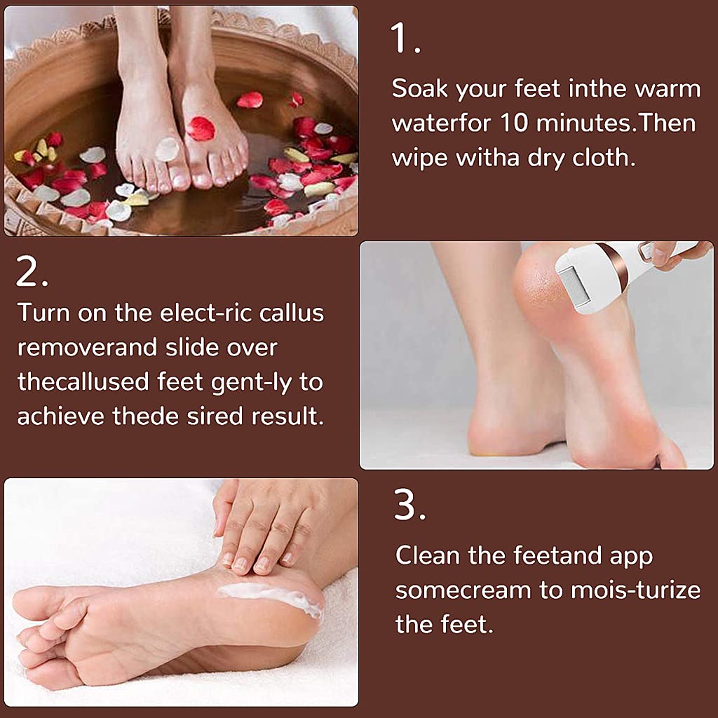 ELEPHANTBOAT Electric Callus Remover for Feet with 3 Quartz Heads and IPX7 Waterproof | Rechargeable 1200mAh Pedicure Tool
