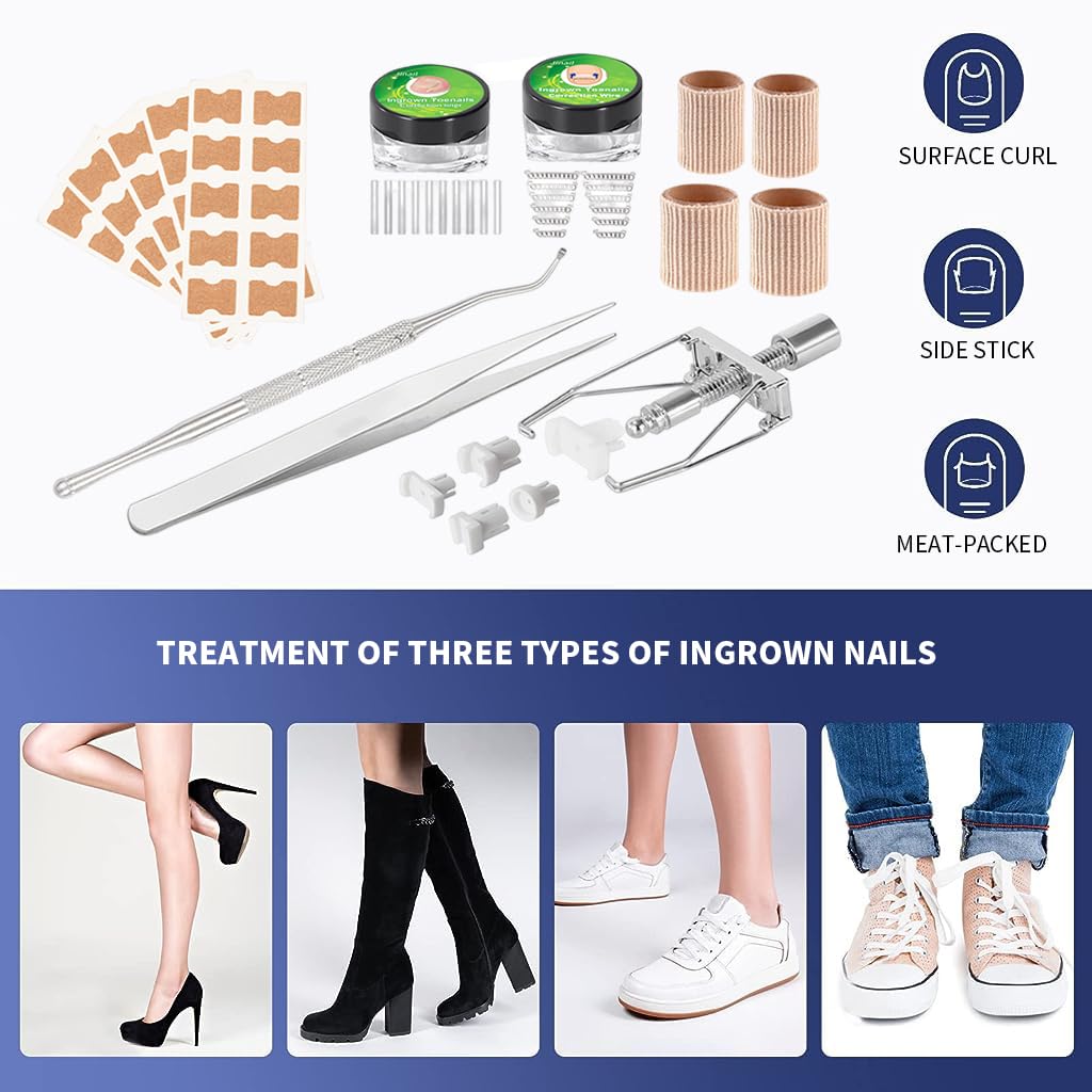 HANNEA Ingrown Toenail Treatment Kit for Home Relief with 50pcs Brace Stickers and Stainless Steel Tools