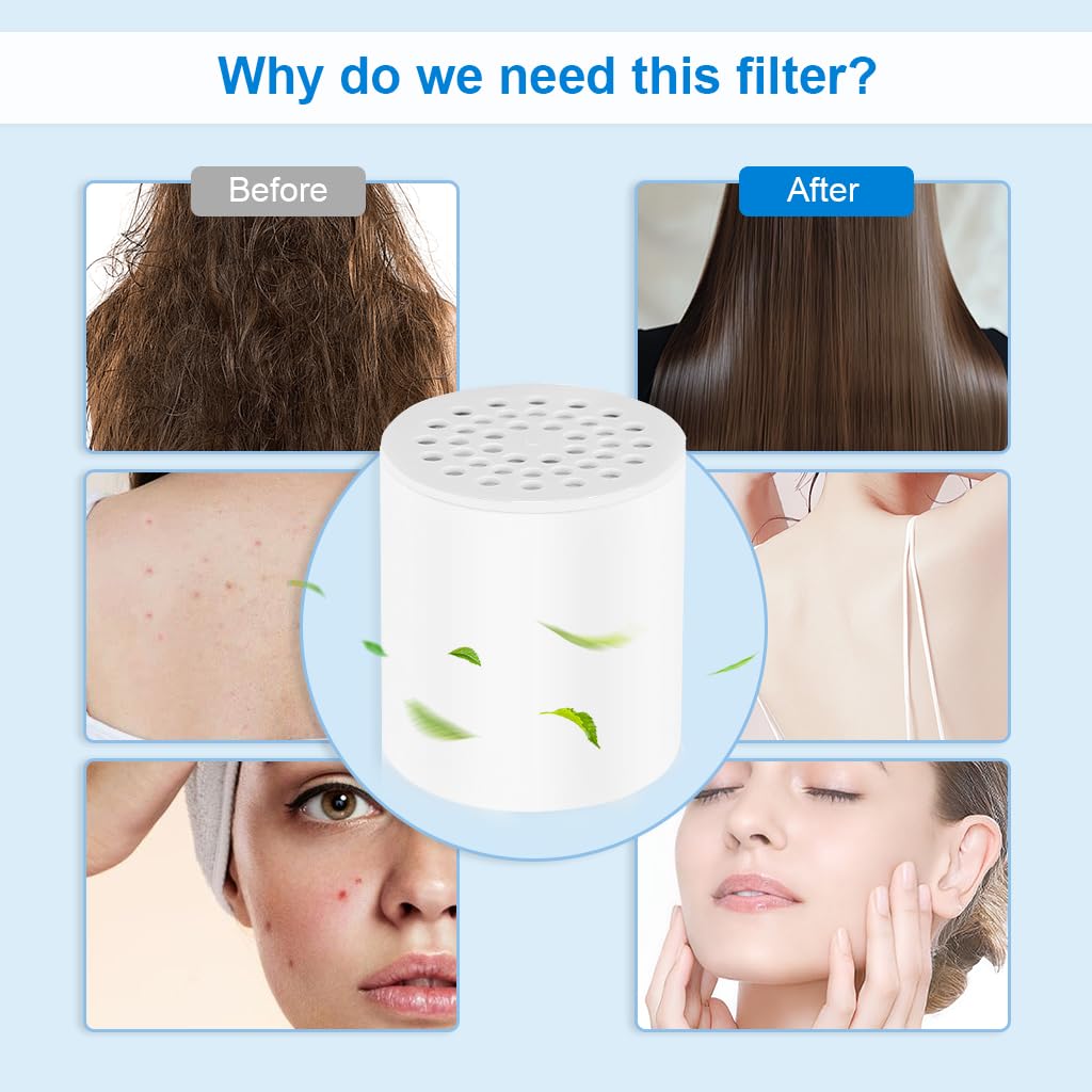 Supvox Shower Water Filter for Cleaner Showers with 22 Stage Filtration | Removes Chlorine and Heavy Metals