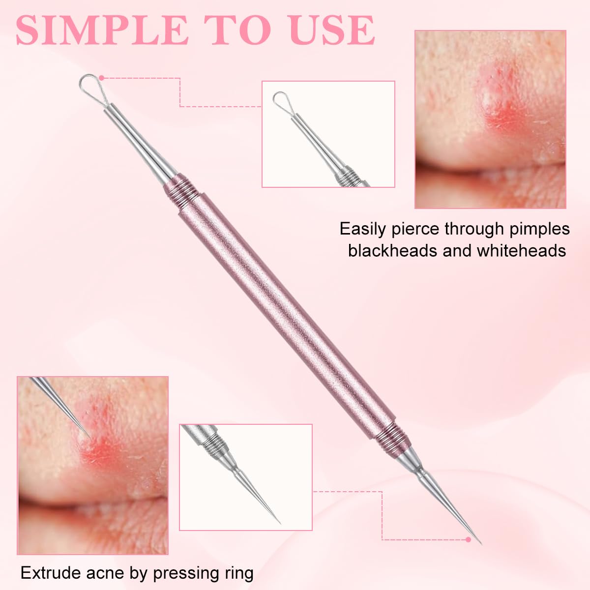 ZIBUYU Blackhead Remover Tool for Acne Extraction with Dual Head 2 in 1 Stainless Steel