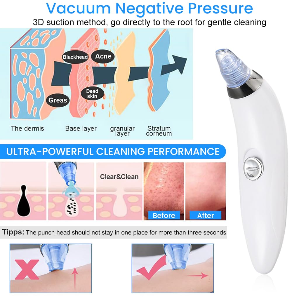 ZIBUYU Blackhead Remover Vacuum for Face with 2 Suction Levels and 4 Nozzles | Battery Powered