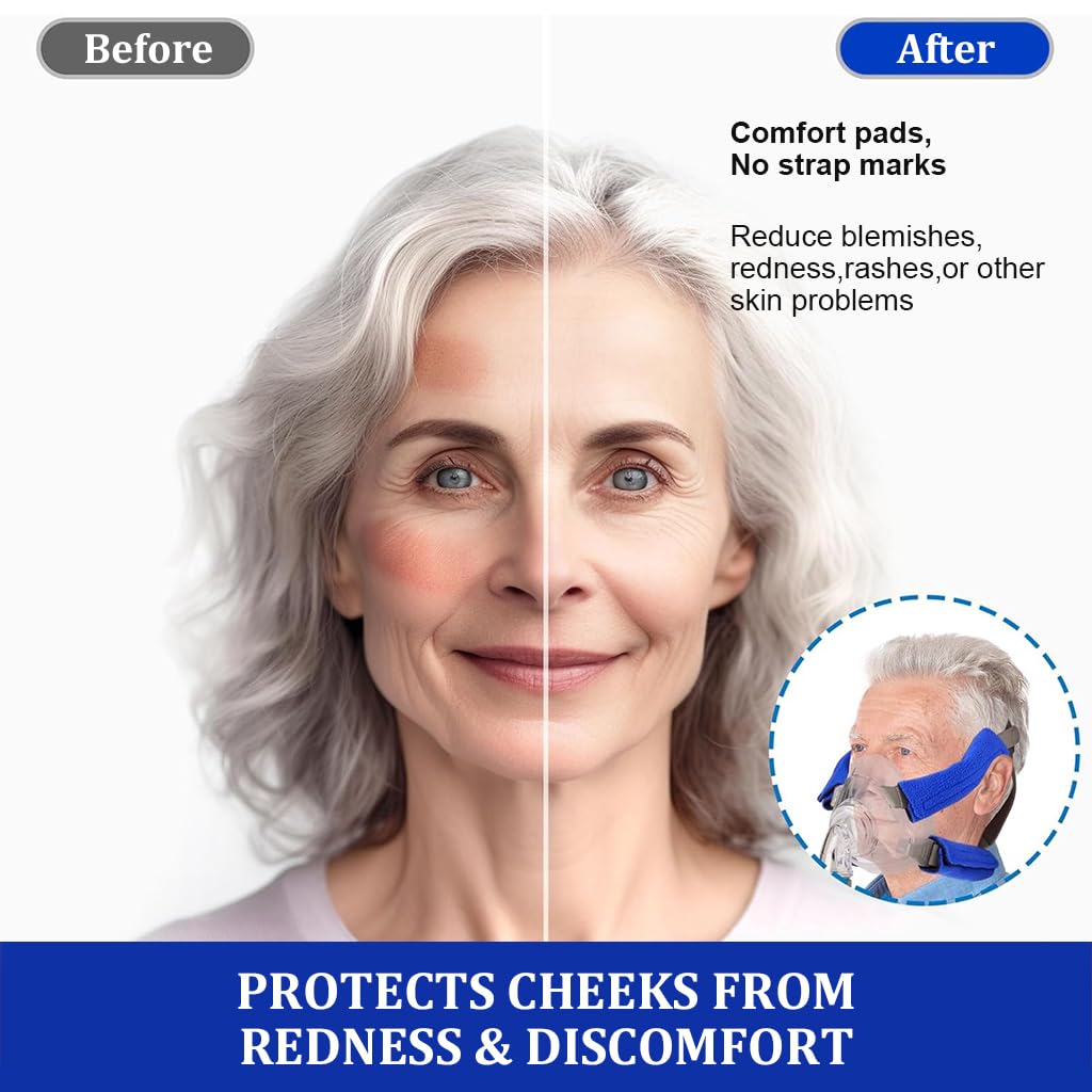 Serplex CPAP Strap Covers for Preventing Friction with Hook and Loop Closure | 4Pcs Plush Wraps for Sensitive Skin