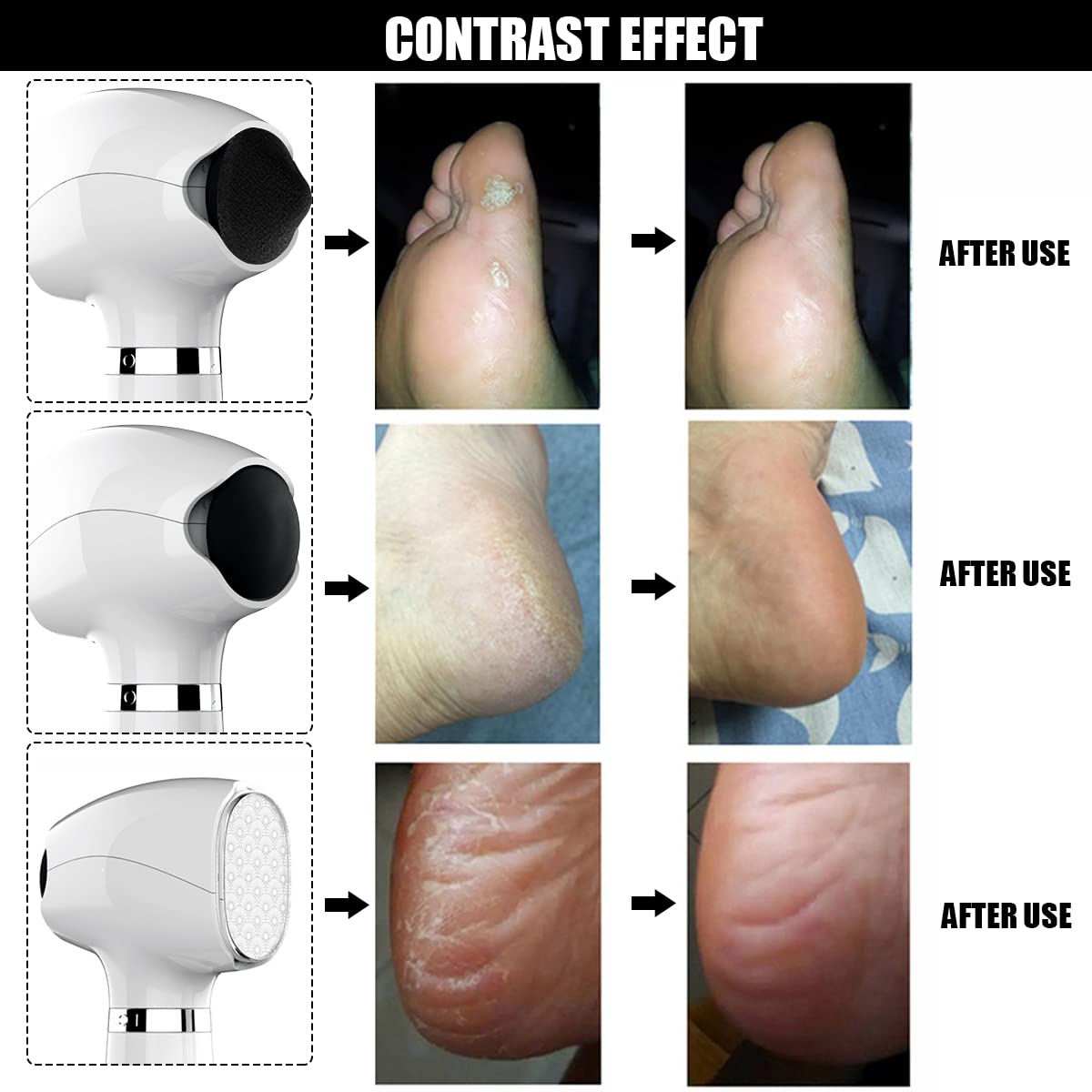 MAYCREATE Callus Remover for Feet with Dual Quartz Heads and Nano Glass Bit | USB Rechargeable 1800mAh