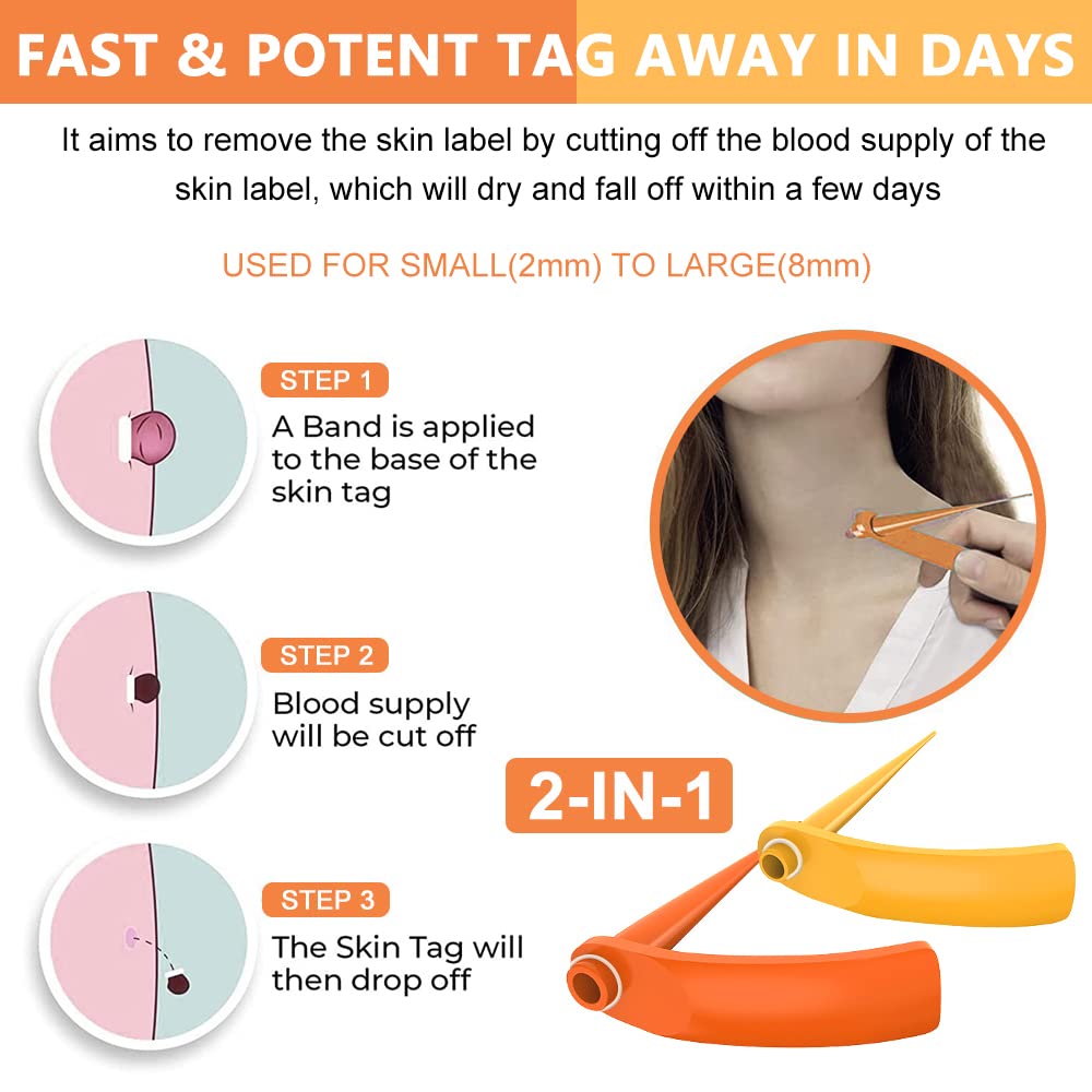 MAYCREATE® Skin Tag Removal Tool 2 in 1 Skin Tag Remover Painless Skin Mole Tag Remover Set Safe and Easy to Remove 2mm-7mm Skin Tags