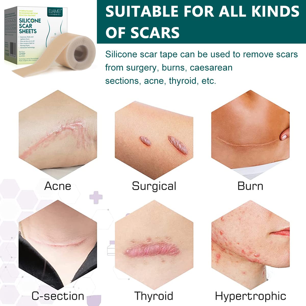 ZIBUYU Silicone Scar Tape for Surgery and C Section Scars 1.6x118 in Roll | Easy Tear Medical Grade