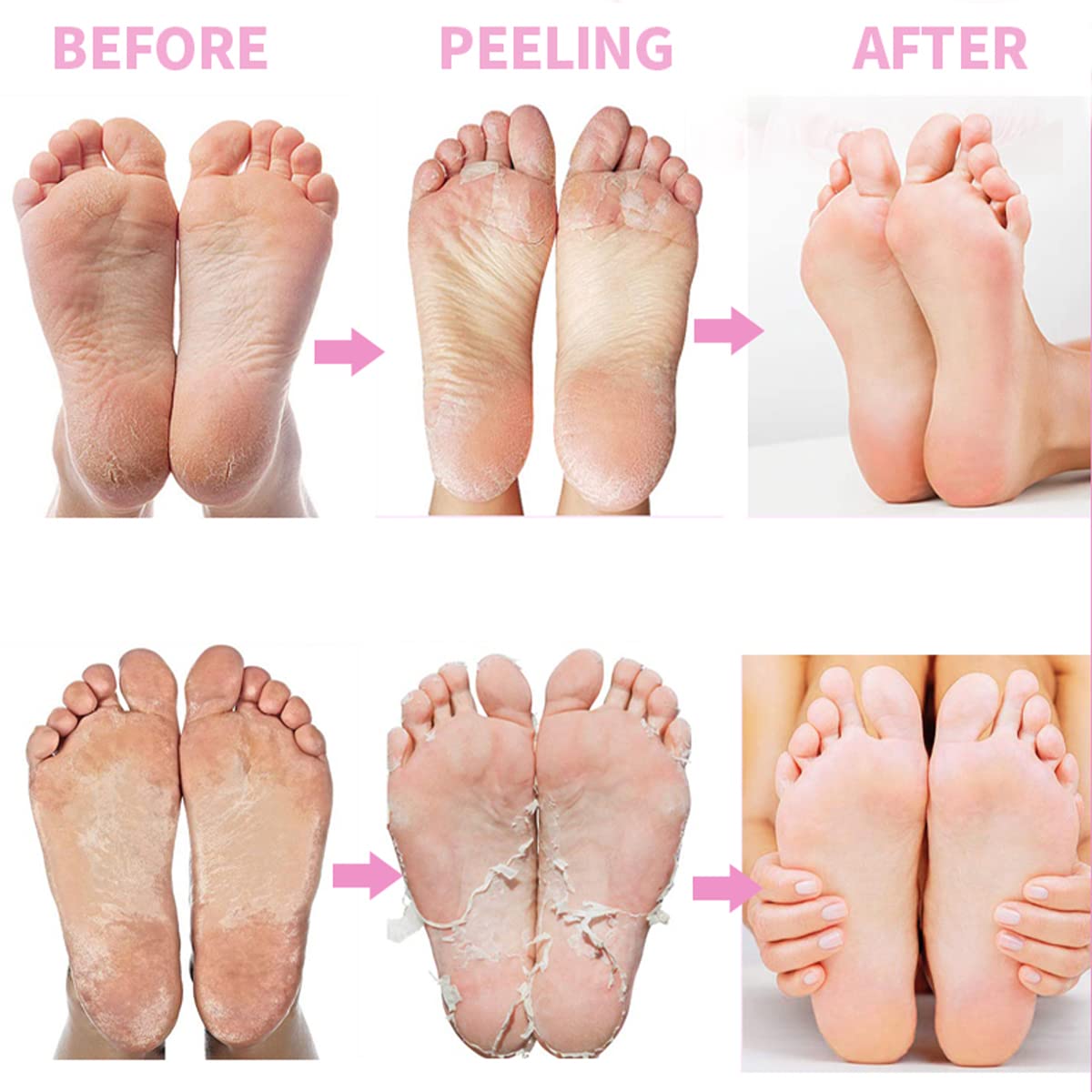 ZIBUYU Rose Exfoliating Foot Peel Mask for Dead Skin Removal with Natural Essence 2 Pairs