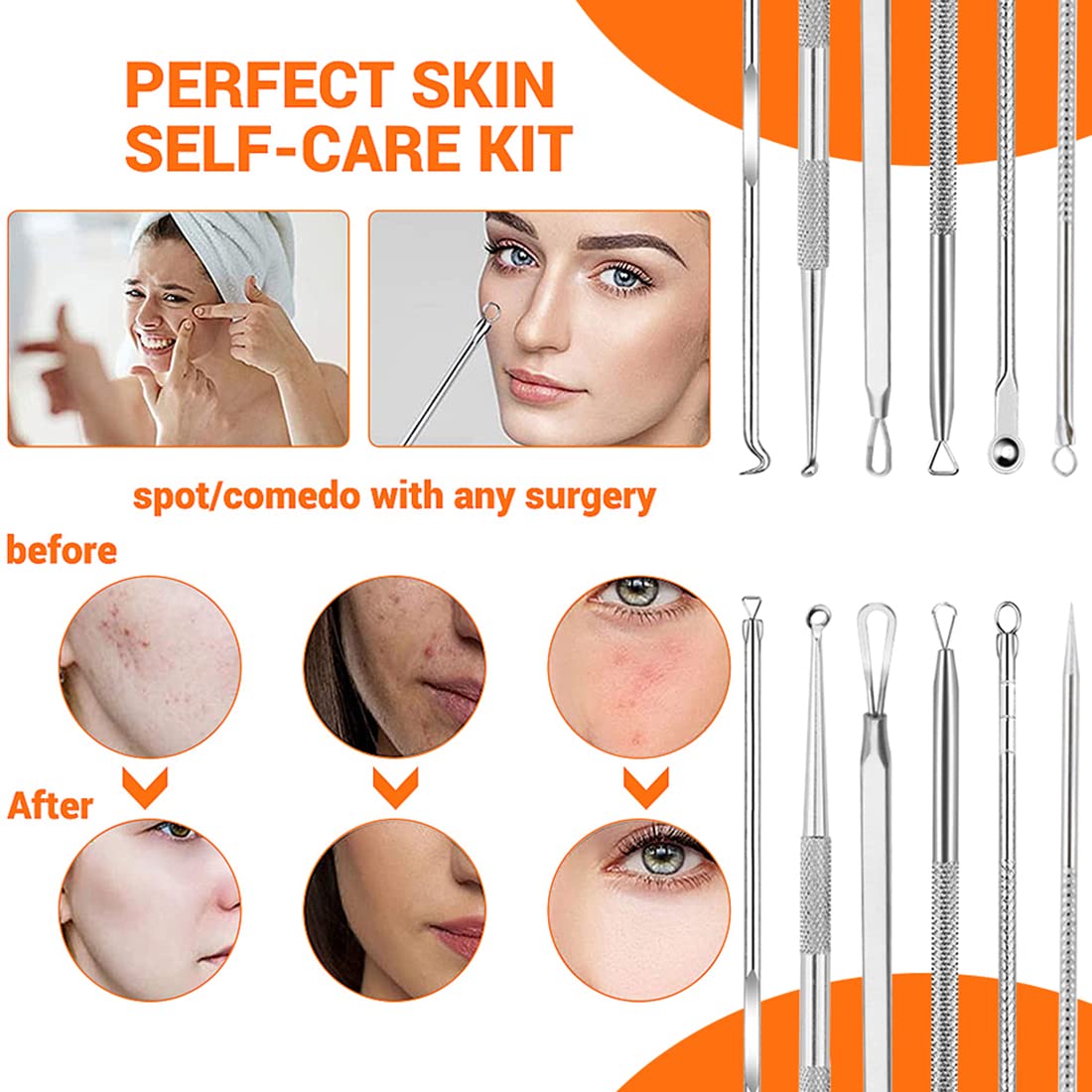 MAYCREATE® 9PCS Blackhead Remover Tools Stainless Steel Blackhead Pimple Blemish Extractor/Remover Tool with Tweezers, Professional Acne Remove Tools