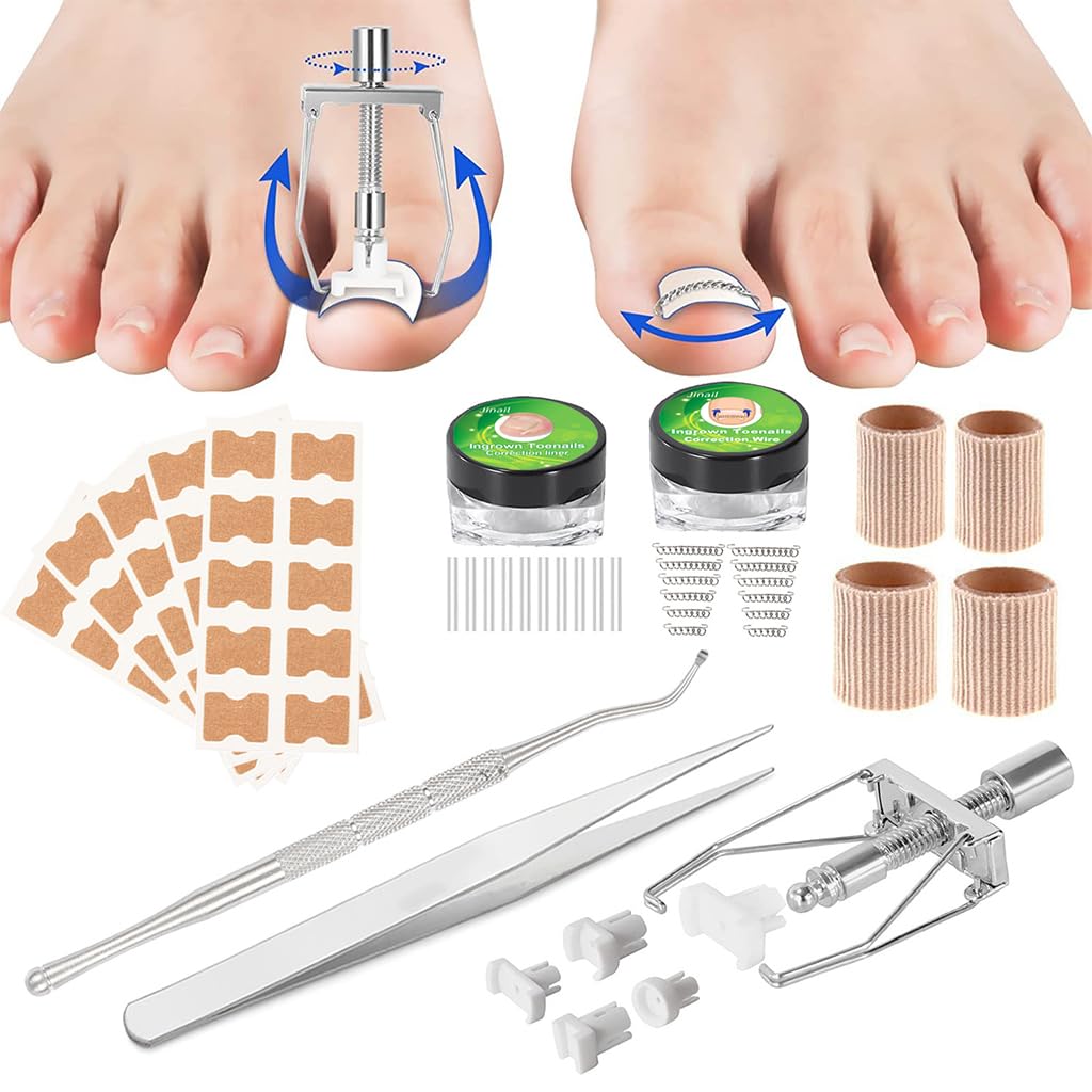 HANNEA Ingrown Toenail Treatment Kit for Home Relief with 50pcs Brace Stickers and Stainless Steel Tools