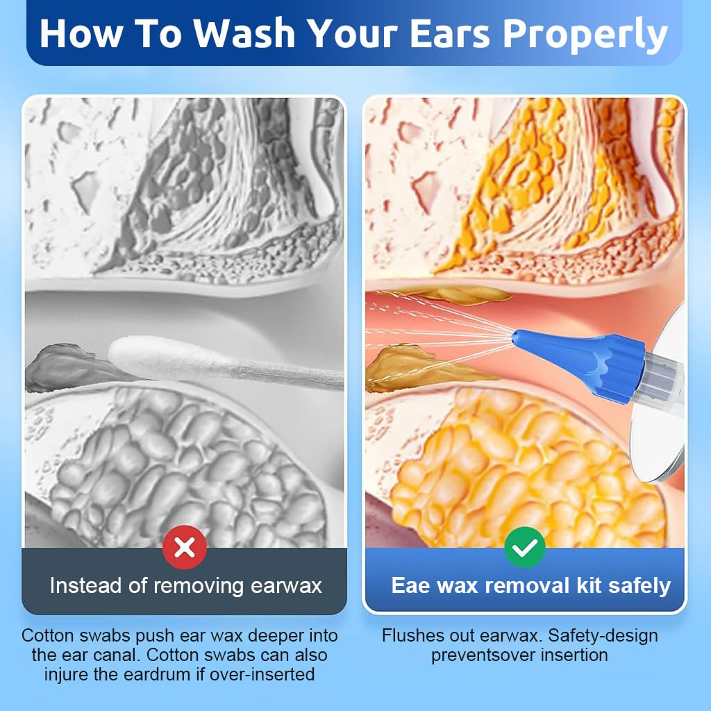 HANNEA Manual Ear Irrigator for Gentle Ear Wax Removal with 10 Nozzles and 250ml Cup | Safe for Adults and Kids